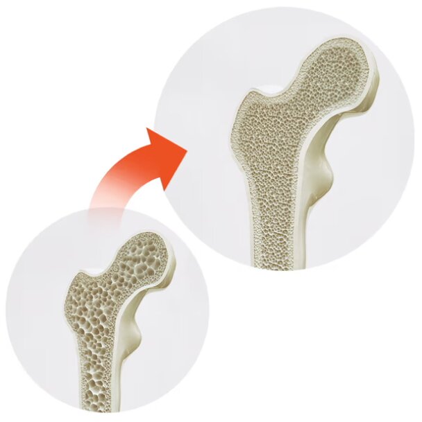 A visual representation shows two cross-sections of a femur bone. The bottom left image shows a bone with large, sparse holes, indicating low bone density. A red arrow points to the image on the top right showing a bone with much smaller, more tightly packed holes, representing an increase in bone density.