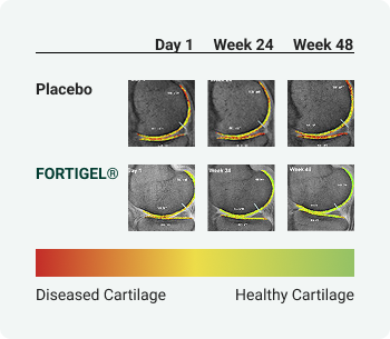  A two-by-three table shows MRI scans of a knee joint. The top row, labeled "Placebo," shows little change from Day 1 to Week 48. The bottom row, labeled "FORTIGEL," shows a change from red and yellow (diseased cartilage) to green and yellow (healthy cartilage).