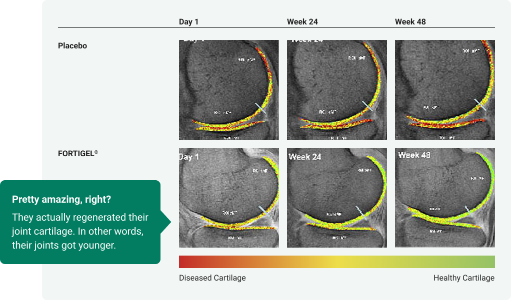 A two-by-three table shows MRI scans of a knee joint. The top row, labeled "Placebo," shows little change from Day 1 to Week 48. The bottom row, labeled "FORTIGEL," shows a change from red and yellow (diseased cartilage) to green and yellow (healthy cartilage).