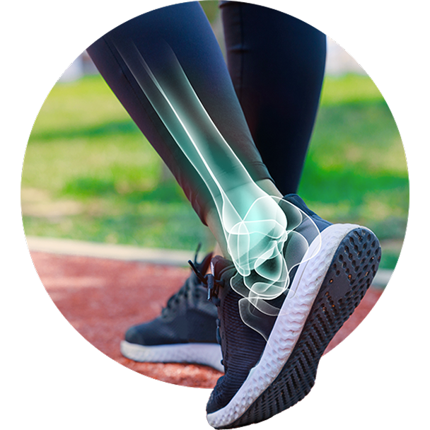 A person's legs are shown from the knees down, with the feet in athletic shoes on a running track. A transparent X-ray overlay highlights the bones of the lower leg, ankle, and foot.