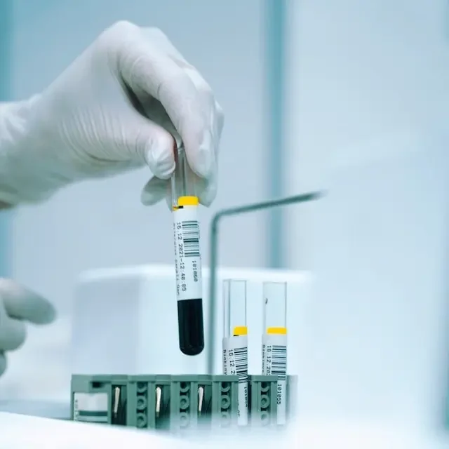 close up of blood tubes being held by gloved hand