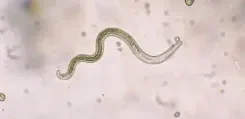 microscope image of an intestinal worm