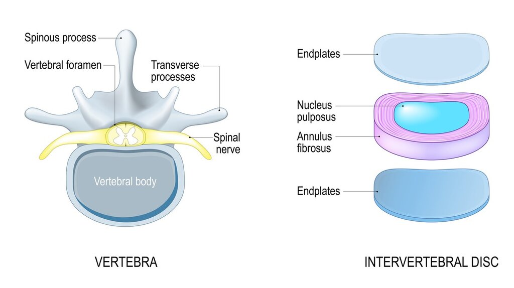 intervertebral disc infographic