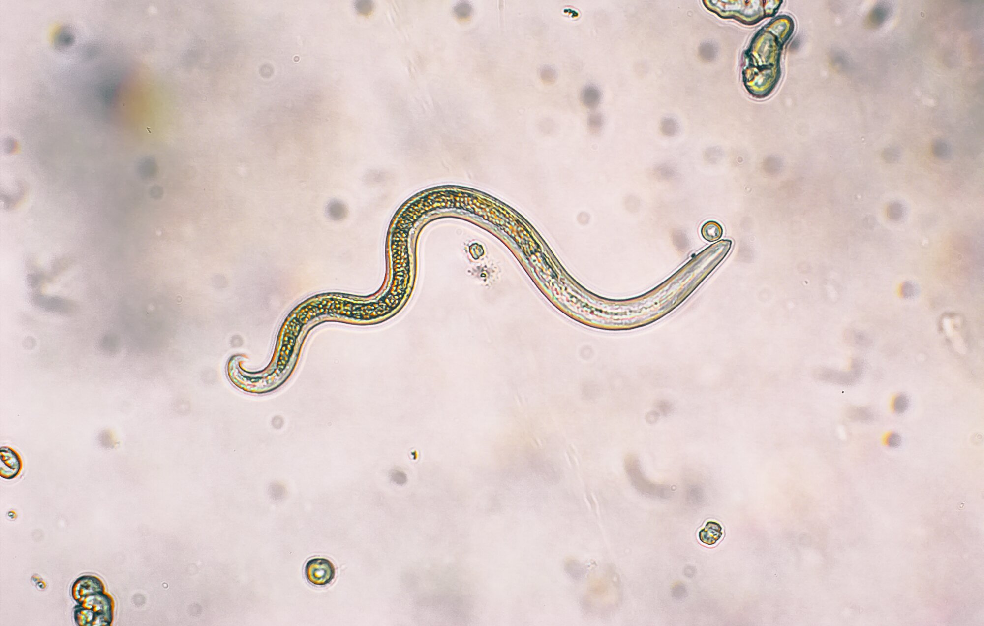 microscopic image of dog roundworm larvae
