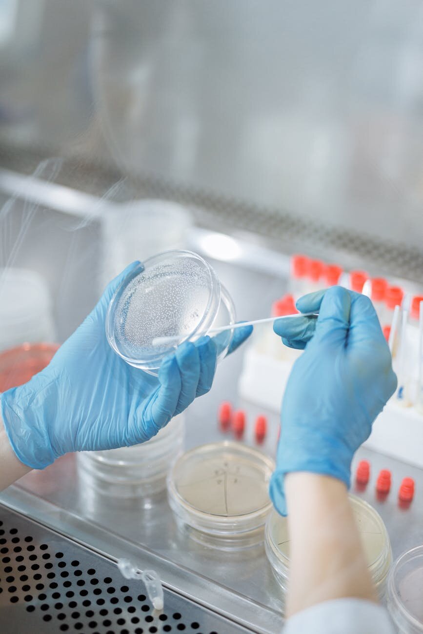 bacterial samples in a petri dish being swabbed for testing