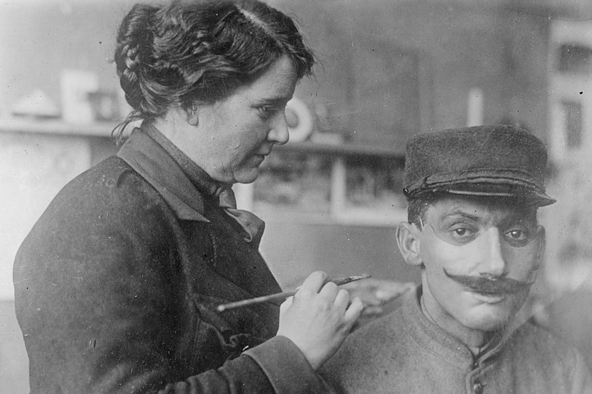 facial reconstruction WWI