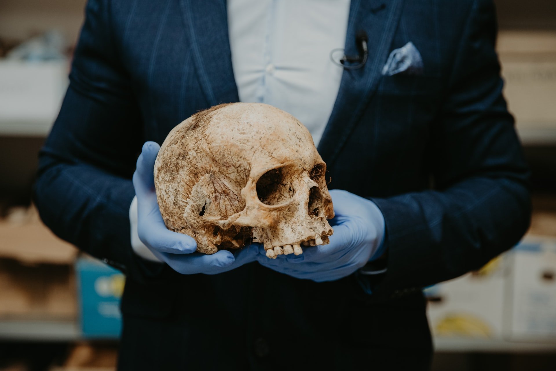 Human remains from a laboratory with archeological samples at the Department of Classical Archeology at Trnava University in Slovakia. Trnava University photo courtesy of Unsplash.