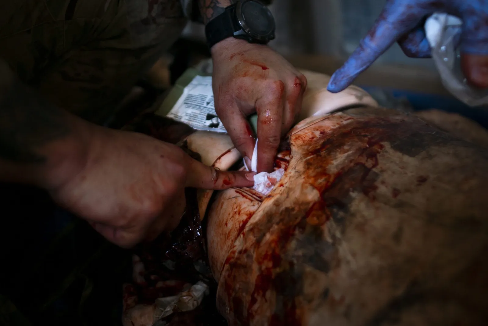 wound packing