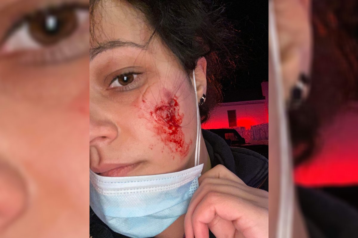 FDNY EMS paramedic Jenna Piscitello attacked and bitten