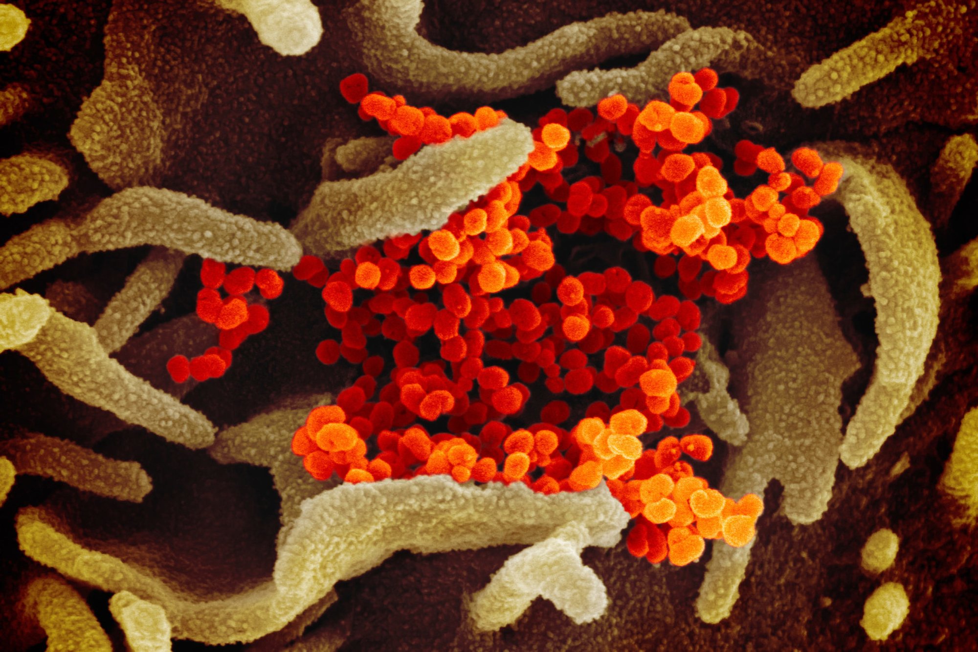 This scanning electron microscope image shows SARS-CoV-2 (orange)—also known as 2019-nCoV, the coronavirus that causes COVID-19—isolated from a patient in the U.S., emerging from the surface of cells (green) cultured in the lab. Photo courtesy the National Institute of Allergy and Infectious Diseases.