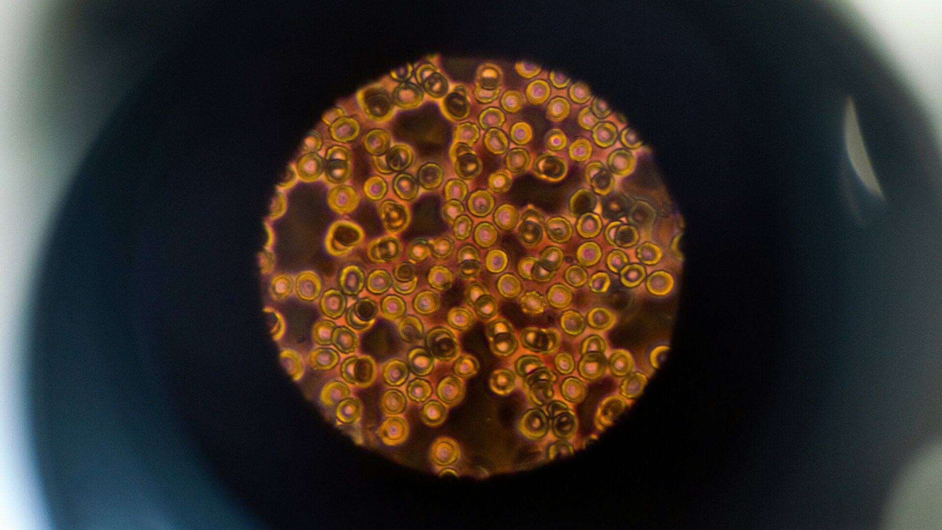 What Does Gut Bacteria Have to Do with Your Liver?