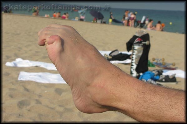 Roberto Aleman's Toe