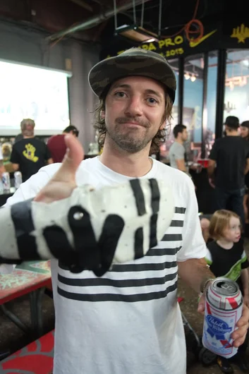 Dan Murphy is getting his middle finger repaired.<!-- Tampa Pro 2013 Thursday and Friday -->