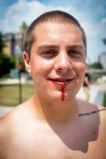 <!--da-chi16-->

Filmer Tim Cisilino got caught up and took a board to the face.