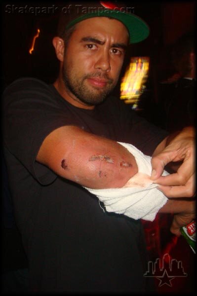 Eric Koston's Elbow