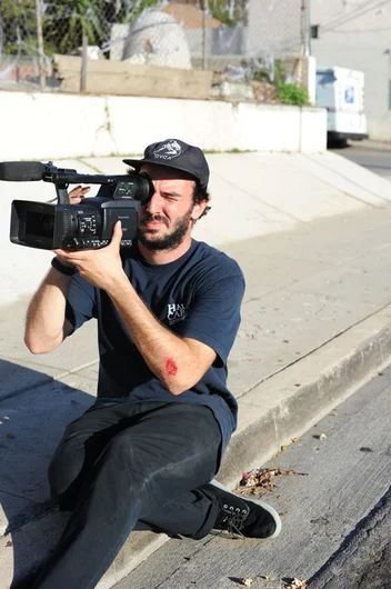 He took a cherry bomb to the elbow.<!-- One Day in East LA -->