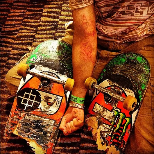 <!--bestofinsta-->

@gupsk8boards got his arm all scratched up wrestling for @ishodwair's board after some kid tried to take it from him. Sweet victory.