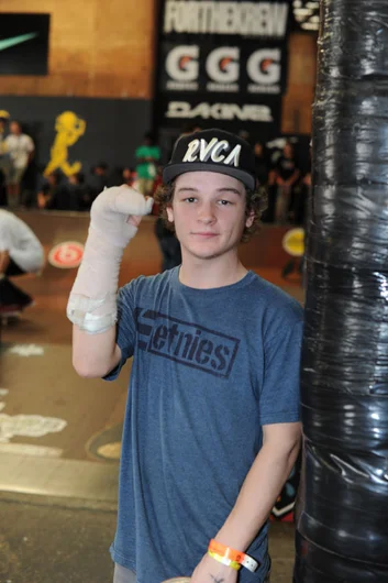 Timmy Johnson broke the same bone in his hand this weekend that I broke a while back.  I had that exact same awkward cast.<!-- Tampa Am 2012 Photos -->