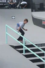 Alex Midler's legs a