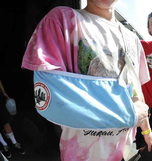 <!-- amdec13fri -->

This is Jason Siebert's broken arm. He came from Chicago to skate but got hurt on Wednesday, the day before the contest officially opened. Bummer, Jason, but thanks for sticking around and supporting SPoT.