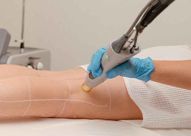 Section ImageA woman wrapped in a towel receives laser hair removal treatment on her legs from a Milan Laser Provider for a blog titled When To Start Laser Hair Removal.