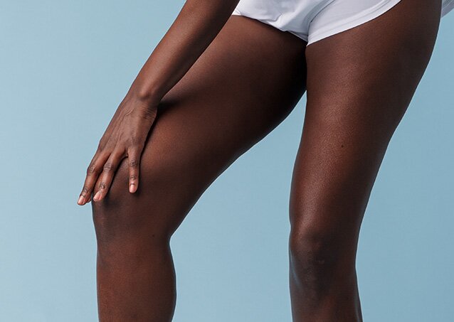 A woman wearing white shorts feels the smoothness of her leg, free of unwanted hair following laser hair removal, for a blog titled What Happens After a Laser Hair Removal Treatment?
