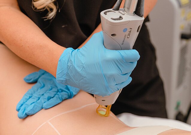 Four women, each with varying skin tones, hair types, and hair colors, pose in an image for a blog titled How Does Hair Color Impact Laser Hair Removal?