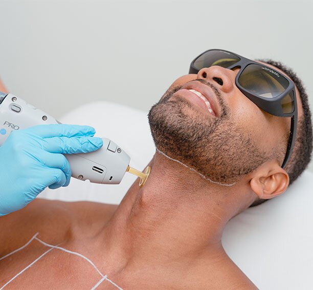 Man getting neck laser hair removal treatments and wearing sunglasses while smiling