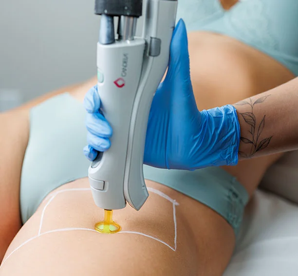 Close-up of a white grid by a teal bikini of a woman getting laser hair removal on her bikini line