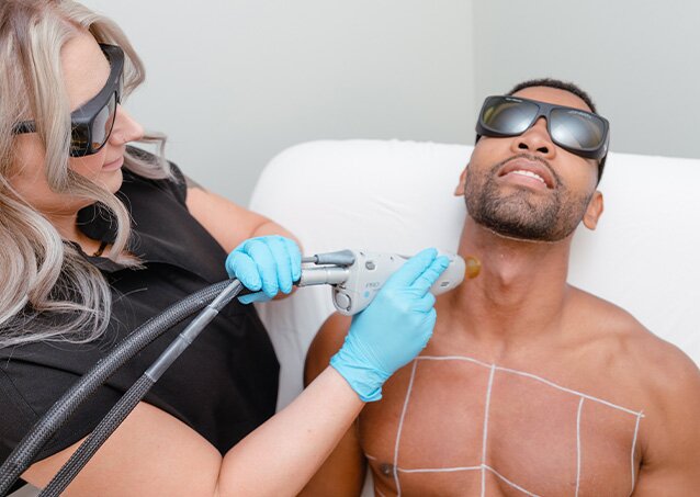 Man with a grid drawn on his chest getting laser hair removal from a woman in black scrubs while wearing protective glasses for a blog posts on laser hair removal and retinoids