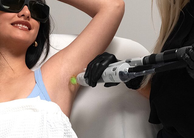 A woman wearing a light-blue top, a white towel, and protective eyewear receives underarm laser hair removal treatment from a Milan Laser Provider in an image for a blog titled Laser Hair Removal Systems Designed For Clinic Efficiency and High Throughput.