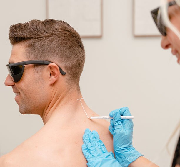 Man smiling and getting a grid marked on his back during his Milan laser hair removal treatment, as seen from over his shoulder