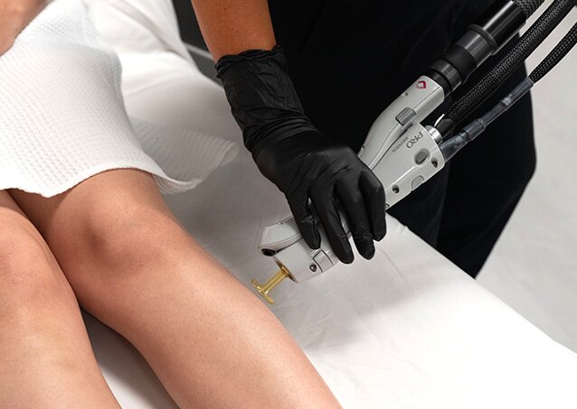 A woman wrapped in a white towel receives laser hair removal treatment on her legs from a Milan Provider in an image for a blog titled Laser Hair Removal Equipment Recommendations For New And Budget-Conscious Clinics.