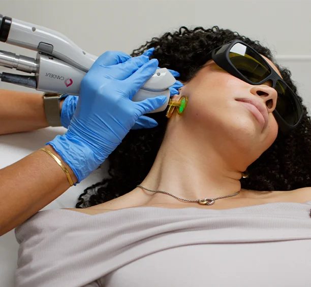 Milan Laser medical professional performing laser hair removal on a client's neck