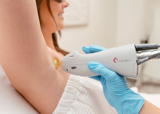A woman wearing a white towel receives laser hair removal on her underarms from a Milan Laser Provider in an image for a blog titled Laser Hair Removal Safety & Hygiene Standards in U.S. Cities.