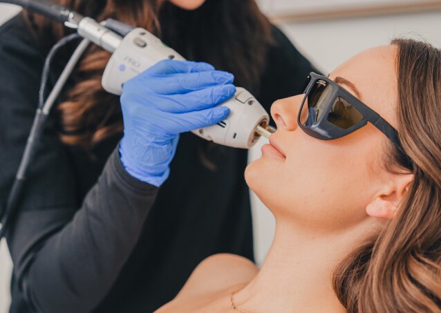 Woman getting laser hair removal as one of the best options for upper lip hair removal
