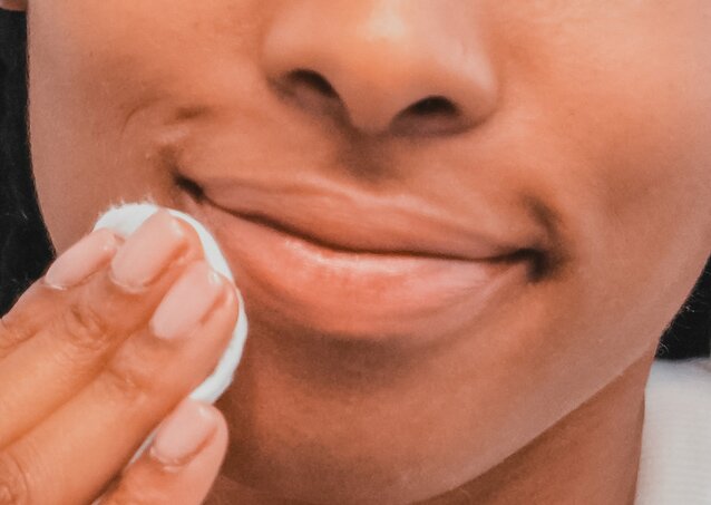 Woman wiping her face with a cotton ball and smiling because she's considering getting laser hair removal with herpes