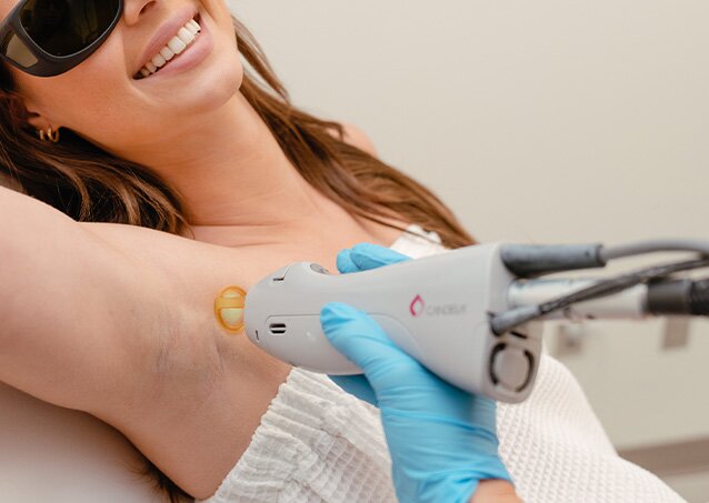 A woman wrapped in a white towel receives laser hair removal on her underarms from a Milan Provider in an image for a blog titled Can Laser Hair Removal Affect Fertility?