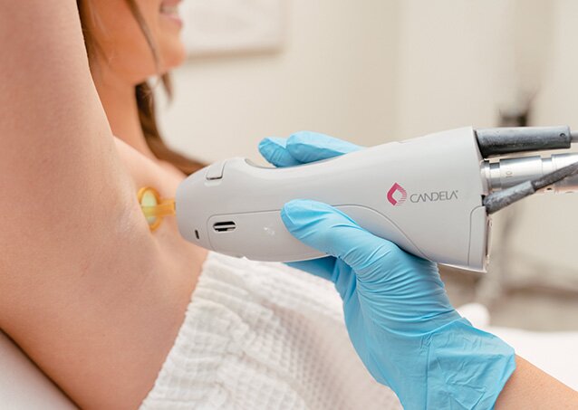 A woman wrapped in a white towel receives underarm laser hair removal treatment from a Milan Laser Provider wearing light blue gloves in an image for a blog titled Durability, Maintenance, and Cost-Effectiveness of Laser Hair Removal Equipment.