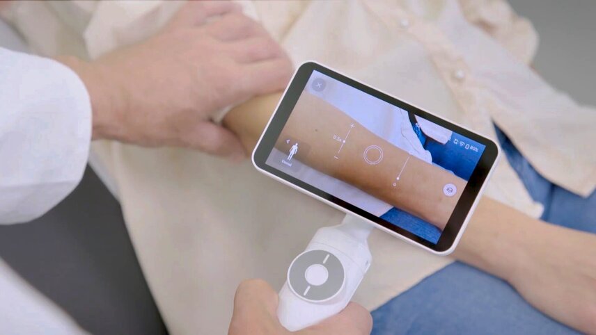 Muttermalkontrolle: Der Hautarzt untersucht mit einem digitalen Dermatoskop die Haut am Unterarm.