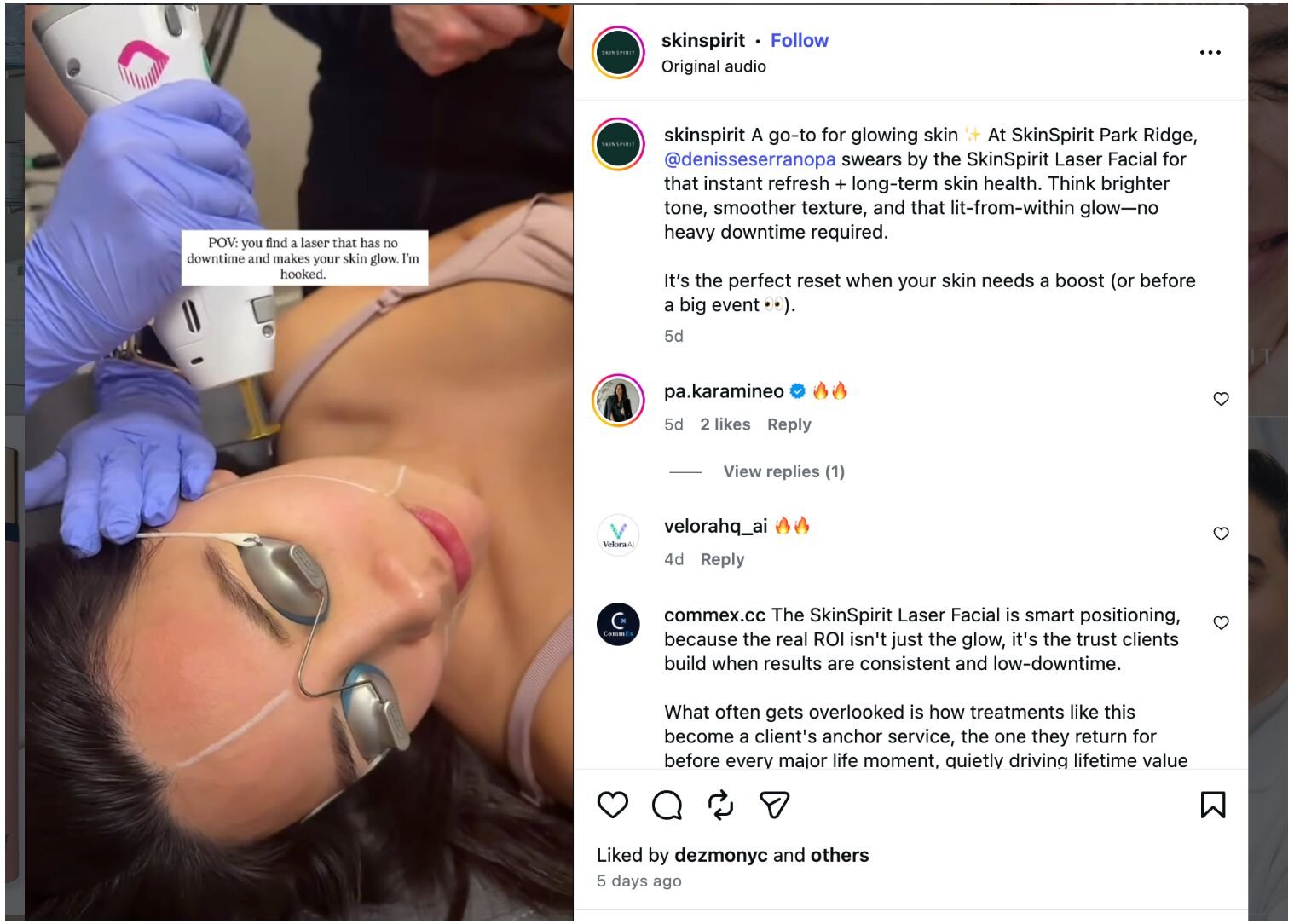 SkinSpirit Instagram post showing a laser facial treatment and caption text about glowing skin with no downtime.