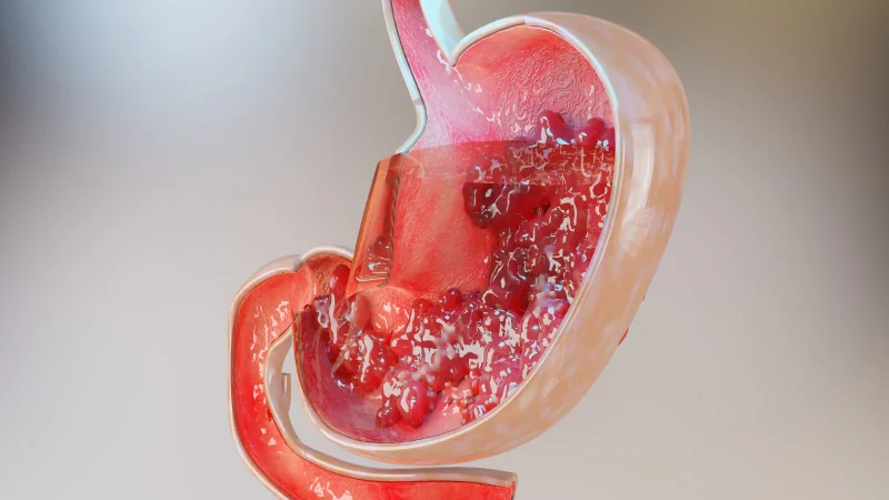 Why Should You Consider Trying Plant-Based Digestive Enzymes?