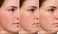 Skin Barrier Cream Guide: Benefits & How to Use