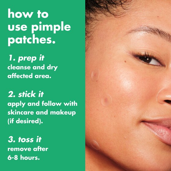 3 Steps to Use Pimple Patches
