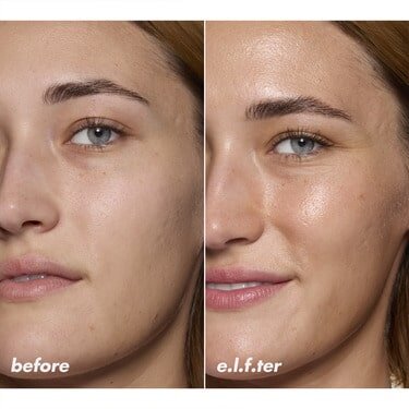 Model Before and After Applying Niacinamide Serum