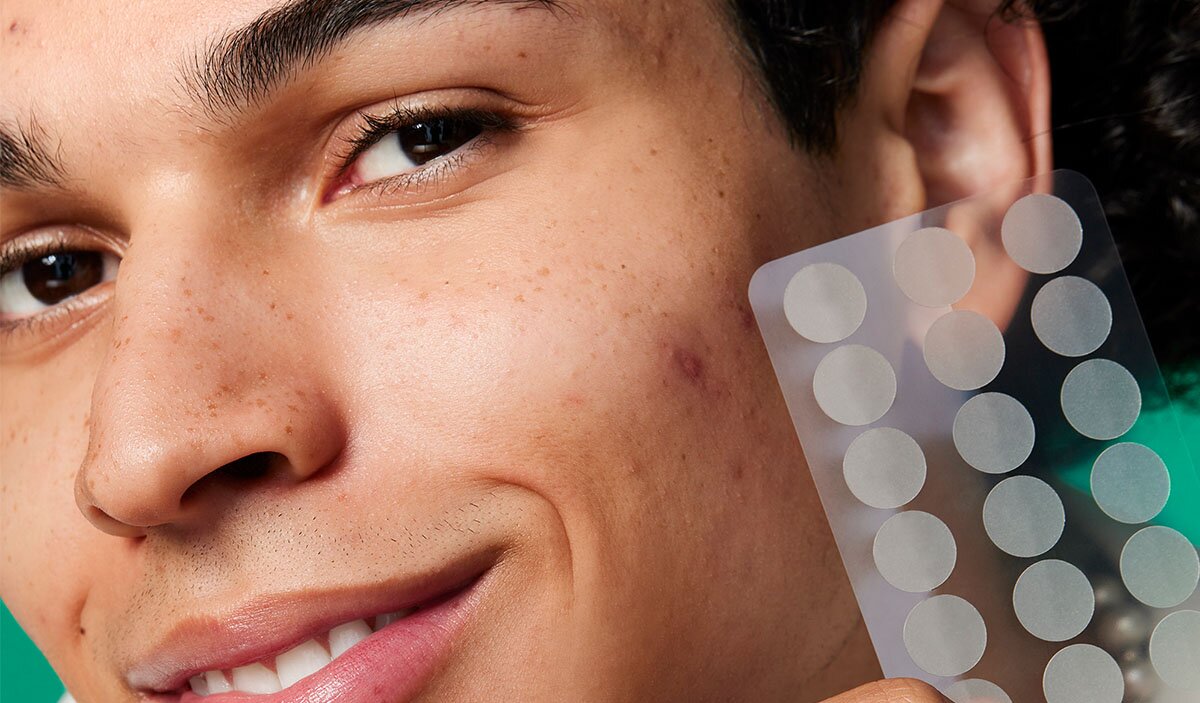 model holding up hydrocolloid pimple patches