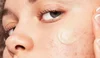 Makeup Routine for Acne-Prone Skin