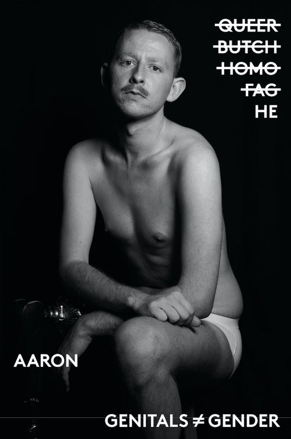 disabled model Aaron Whitty - Zebedee Talent