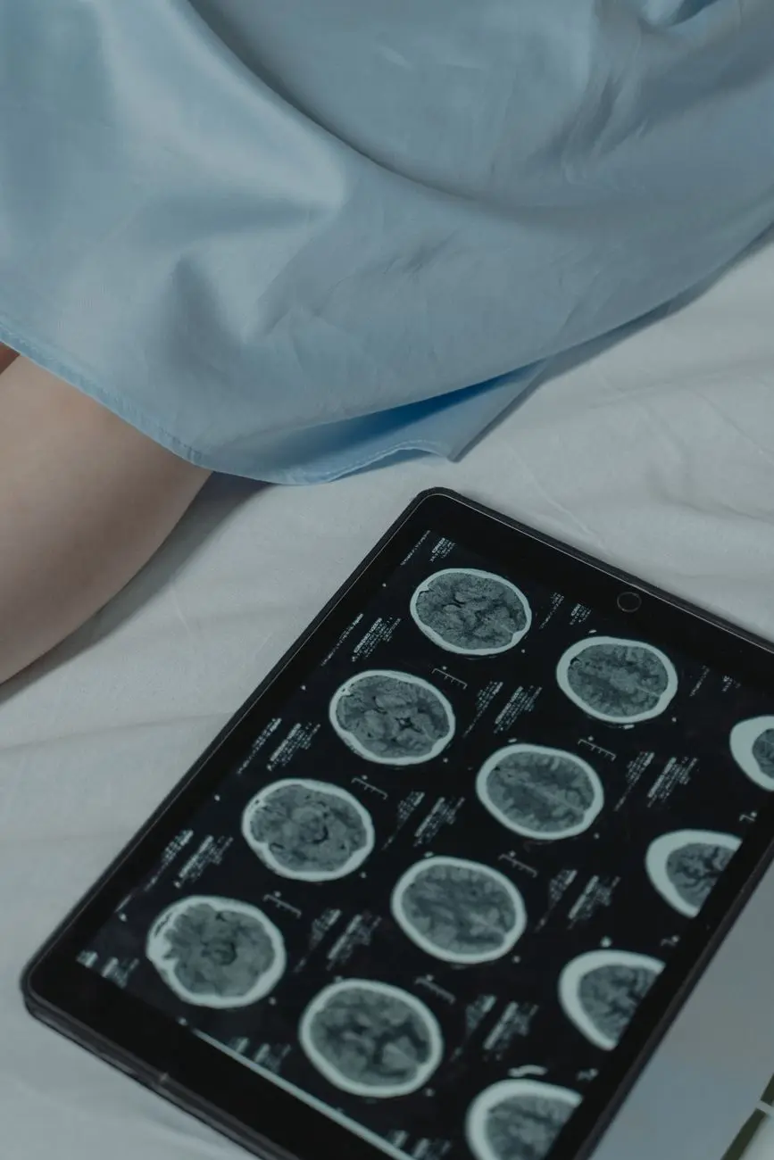 A $152 Policy, a $24,315 Brain Injury in Thailand | LUMA Travel Claim Stories