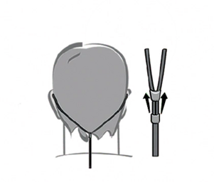 IEM insertion guide graphic